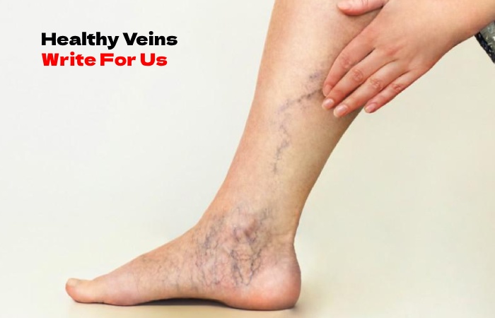Healthy Veins Write For Us